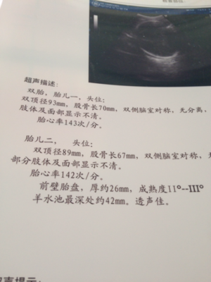 足月胎儿股骨长标准