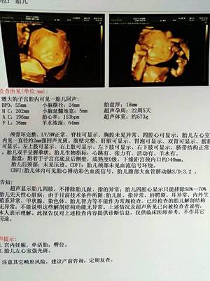 五个多月的胎儿有多大