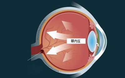 眼压低是怎么回事