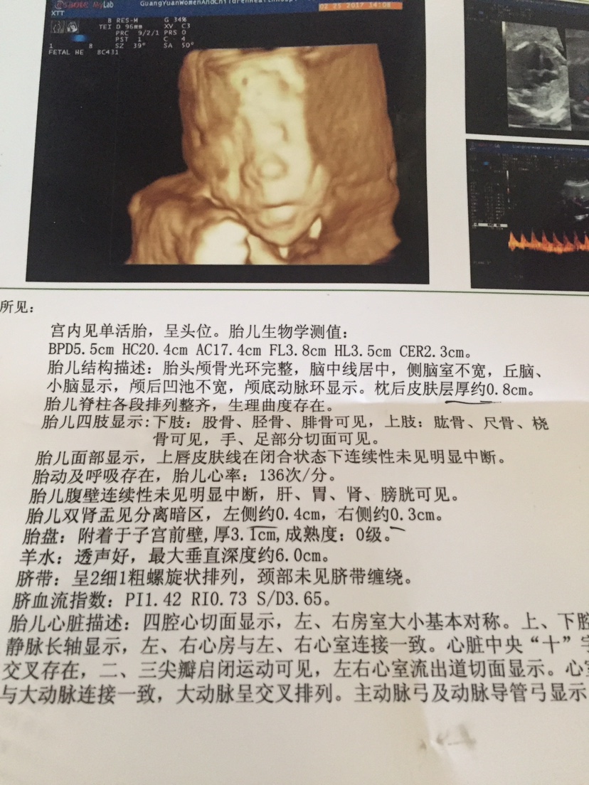 胎儿22周图片