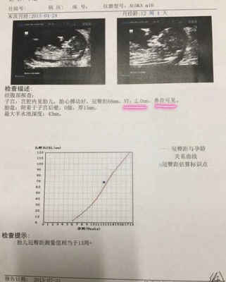 测胎儿大小