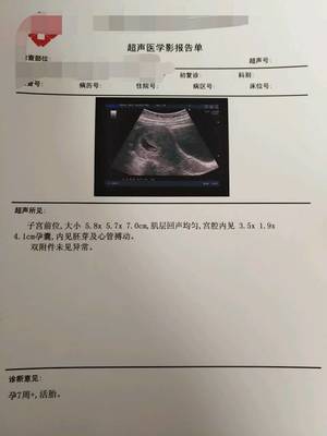 怎么测试男女宝宝最准