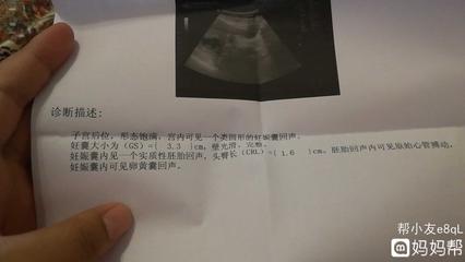 两个月没有胎心