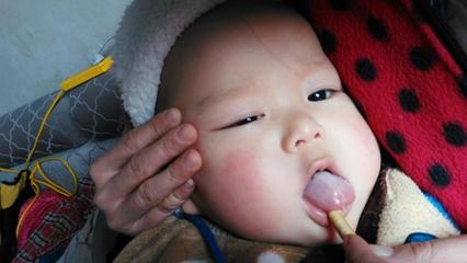 一个月的宝宝可以吃感冒药吗