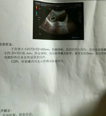怎么测试男女宝宝最准
