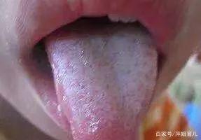 舌苔白又厚是怎么回事