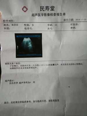 怀孕老咳嗽怎么办