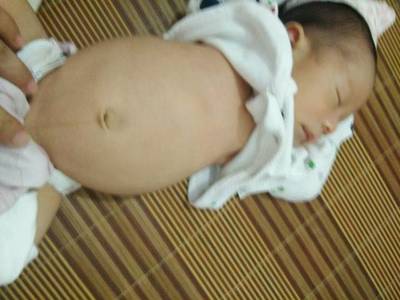 1岁宝宝肚子大正常吗