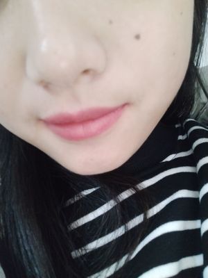 点痣挂什么号