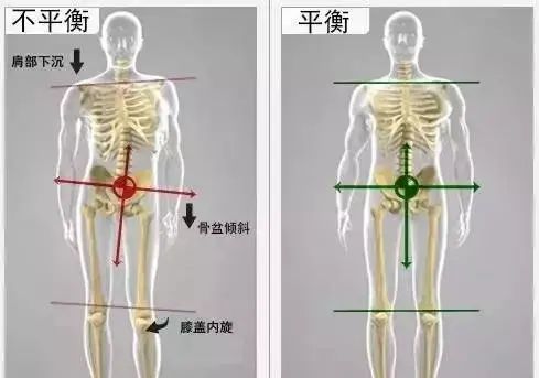 高低肩是怎么回事