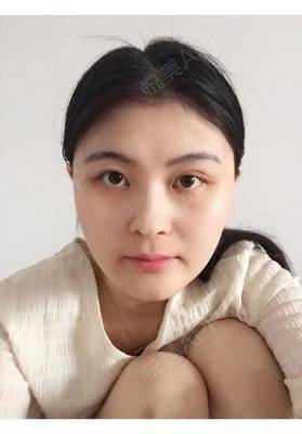 多层眼皮的人很漂亮