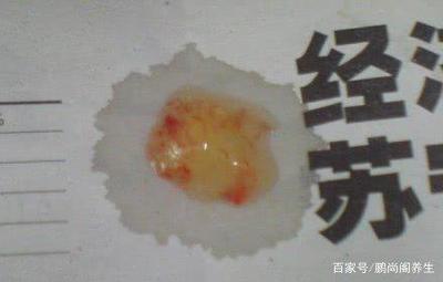 痰中带少量血丝是怎么回事