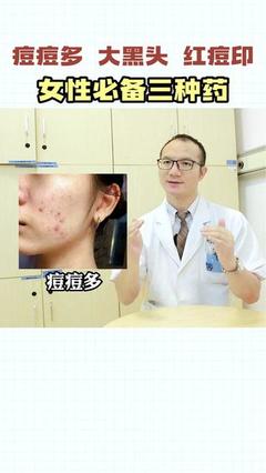 男士去痘痘药膏哪个好