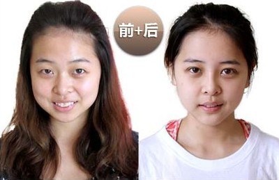 用什么可以瘦脸