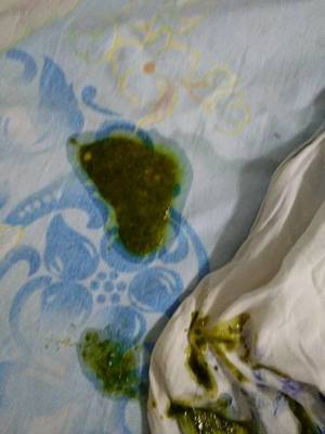 宝宝拉粑粑绿色