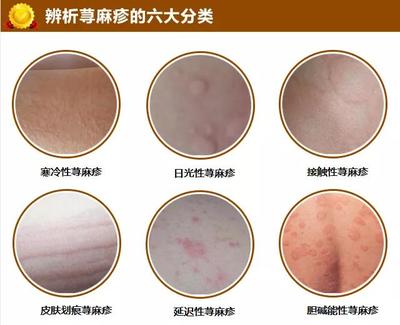 身上麻是怎么回事