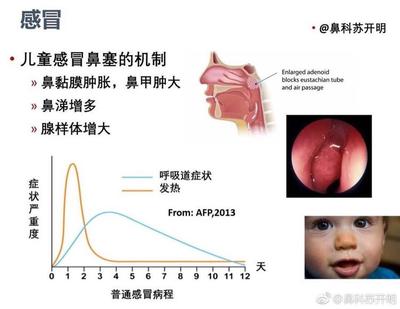 鼻粘膜肿大怎么治疗
