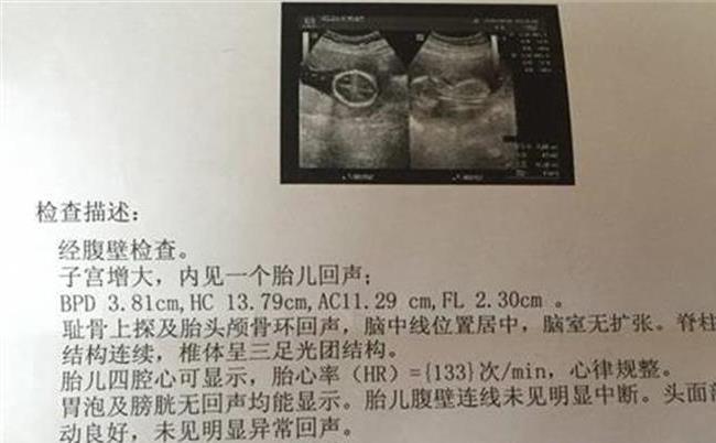 怀孕十七周有胎动吗