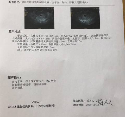 怀孕五周见红怎么回事