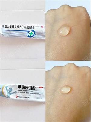 鼻子上痘痘用什么药膏
