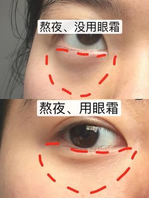 小宝宝卧蚕眼图片
