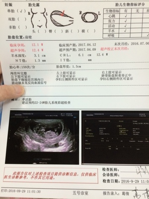12周胎儿nt值正常范围