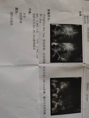怀孕几周能看到孕囊