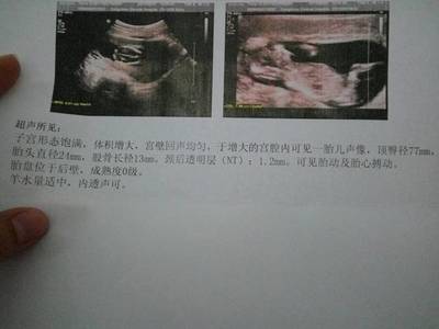 怀孕11周宝宝多大图片
