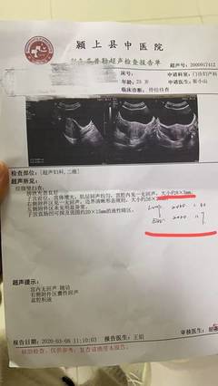 怎么去医院检查怀孕