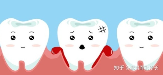 牙根出血是怎么回事
