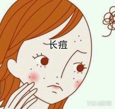 人中长痘痘怎么遮