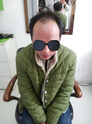 子宫内膜增厚一定要刮宫吗
