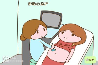 胎心监护胎儿不动