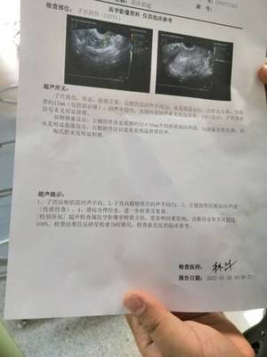 怀孕四十天需要做什么检查