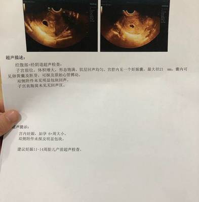 吃了布洛芬多久可以怀孕