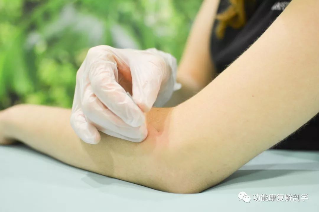 网球炎怎么治疗