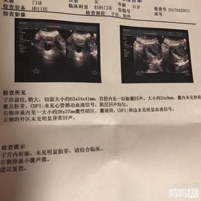 怀孕流褐色血
