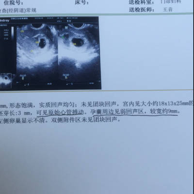 我能摆脱hiv5周围的阴气吗?三代五周的阴害了很多人