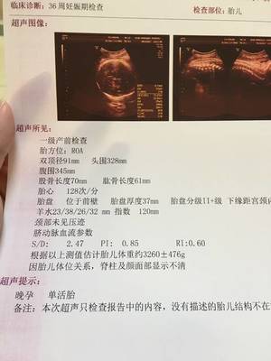 胎儿什么时候长的最快