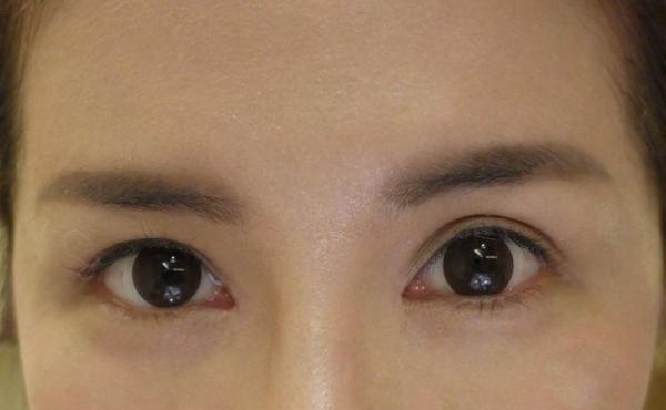 双眼皮什么时候贴