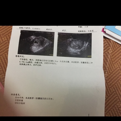 怀孕胚芽是什么意思