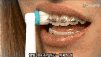 牙齿做牙套