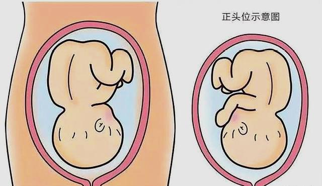 孕晚期胎儿姿势