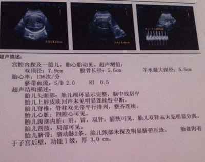 胎儿一般多久有胎心