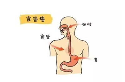 偶尔食道疼是怎么回事