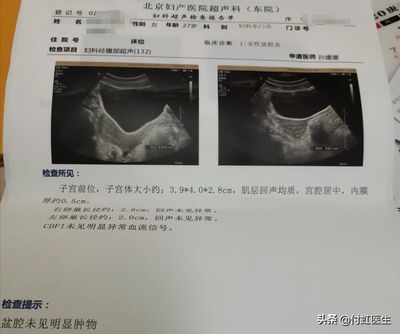 人流三次还能怀孕吗
