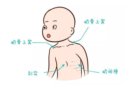 正常宝宝的肋骨图片