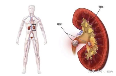 肾的两边疼是怎么回事