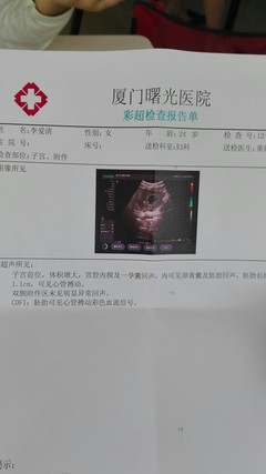 怀孕了怎么看男女