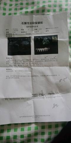 怀孕几周去医院建档